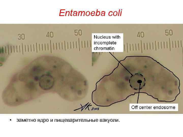 Entamoeba coli • заметно ядро и пищеварительные вакуоли. 