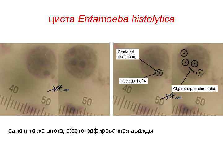 циста Entamoeba histolytica одна и та же циста, сфотографированная дважды 