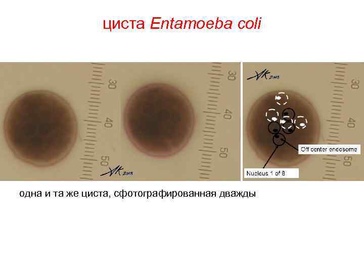 циста Entamoeba coli одна и та же циста, сфотографированная дважды 