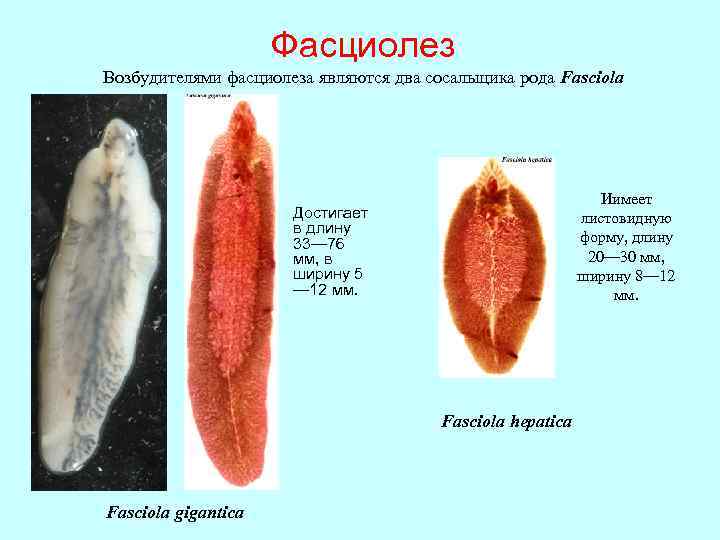 Фасциолез Возбудителями фасциолеза являются два сосальщика рода Fasciola Иимеет листовидную форму, длину 20— 30