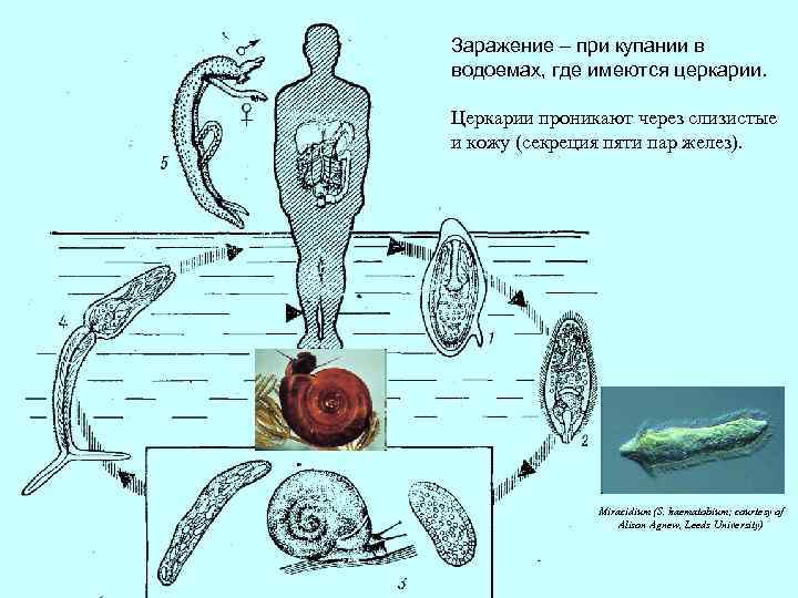 Заражение – при купании в водоемах, где имеются церкарии. Церкарии проникают через слизистые и