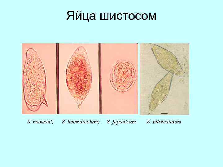 Яйца шистосом S. mansoni; S. haematobium; S. japonicum S. intercalatum 