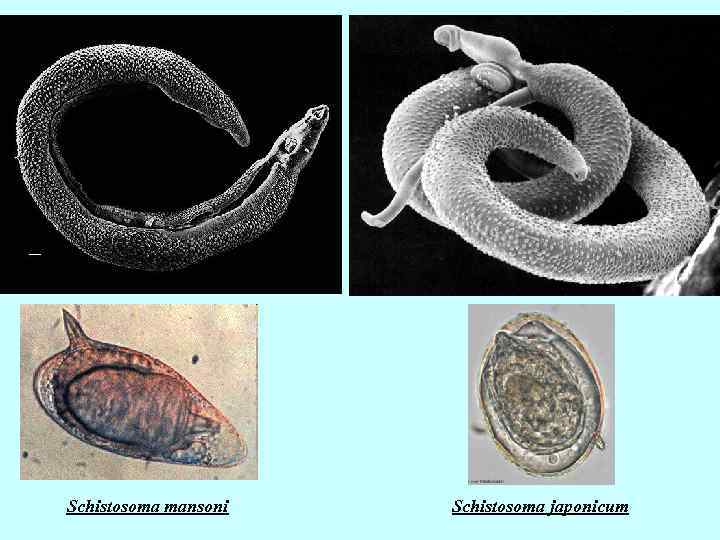 Schistosoma mansoni Schistosoma japonicum 