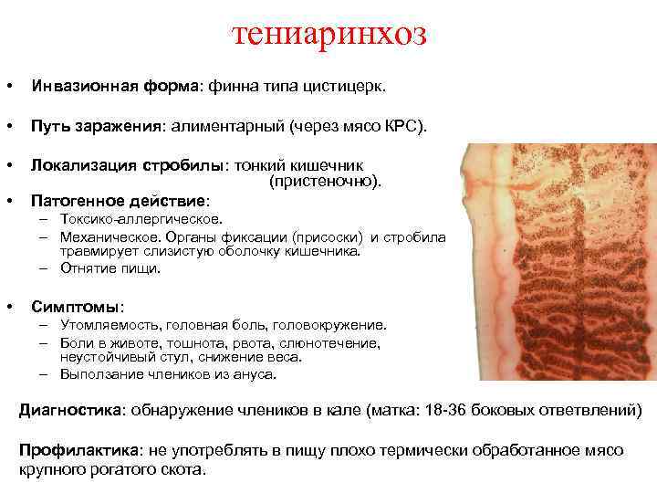 тениаринхоз • Инвазионная форма: финна типа цистицерк. • Путь заражения: алиментарный (через мясо КРС).
