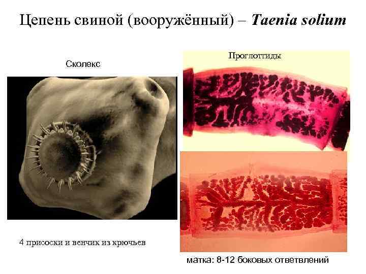 Цепень свиной (вооружённый) – Taenia solium Сколекс Проглоттиды 4 присоски и венчик из крючьев