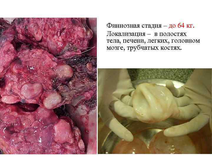 Финнозная стадия – до 64 кг. Локализация – в полостях тела, печени, легких, головном