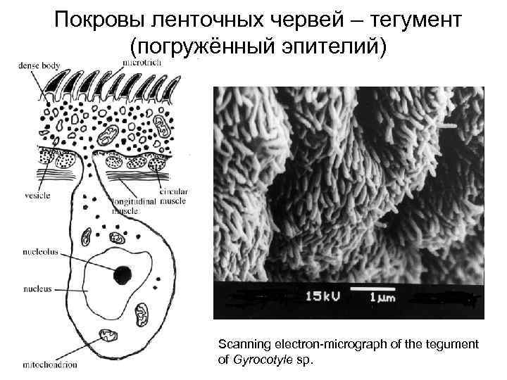 Строение ленточных червей рисунок с подписями