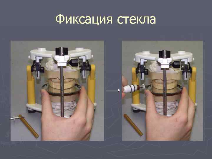 Фиксация стекла 