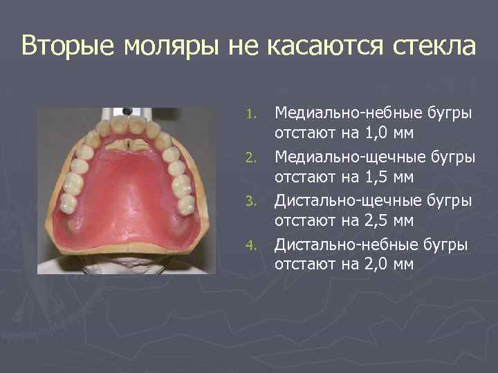 Вторые моляры не касаются стекла 1. 2. 3. 4. Медиально-небные бугры отстают на 1,