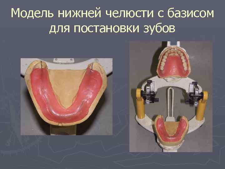 Модель нижней челюсти с базисом для постановки зубов 