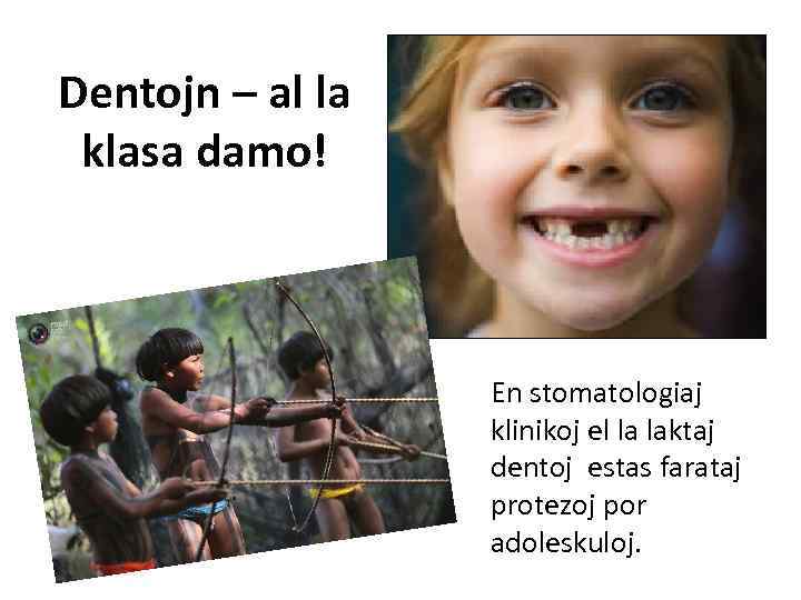 Dentojn – al la klasa damo! En stomatologiaj klinikoj el la laktaj dentoj estas
