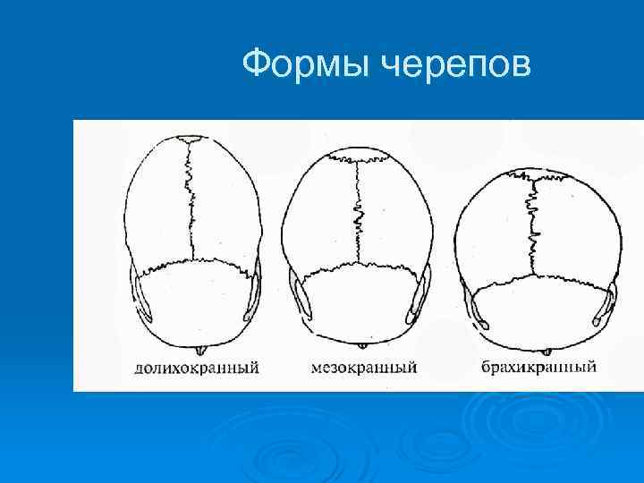 Формы черепов 