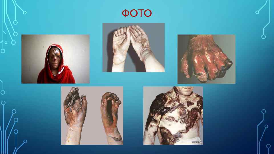 ФОТО 