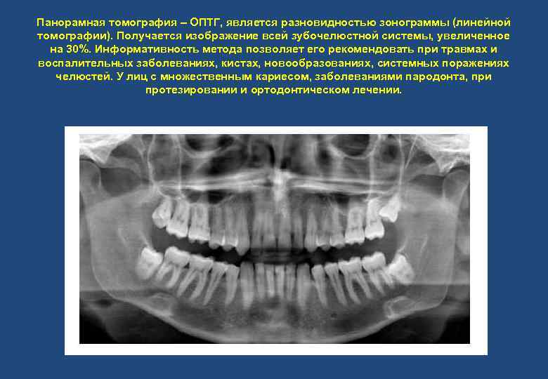 Схема описания оптг