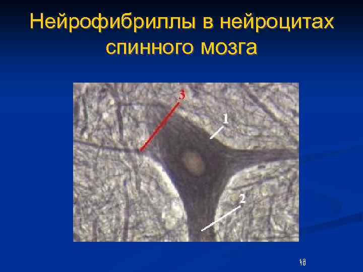 Нейрофибриллы в нейроцитах спинного мозга 13 10 