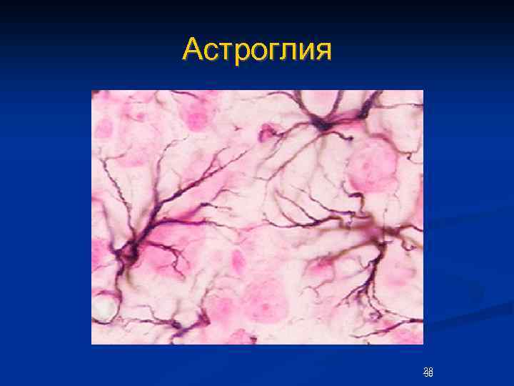 Астроглия 28 30 
