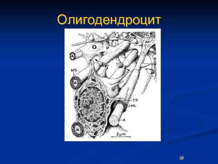 Олигодендроцит 29 31 