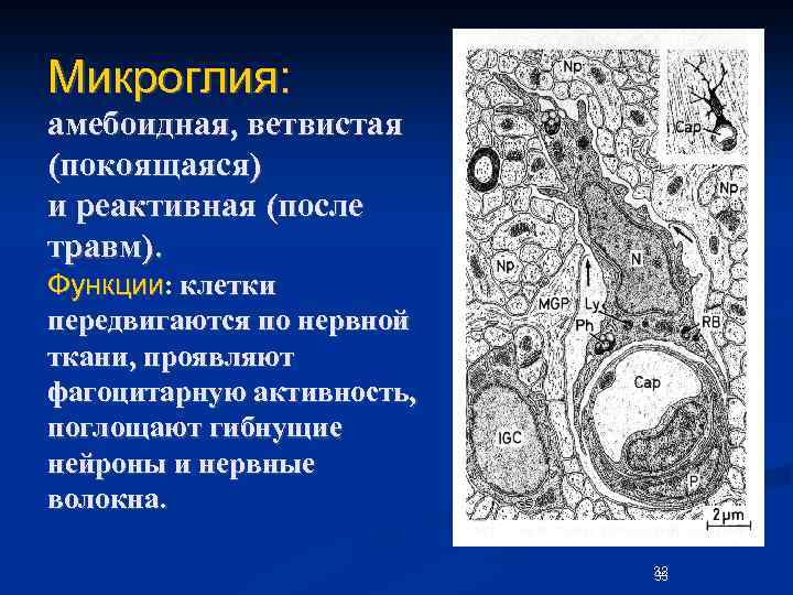Микроглия: амебоидная, ветвистая (покоящаяся) и реактивная (после травм). Функции: клетки передвигаются по нервной ткани,