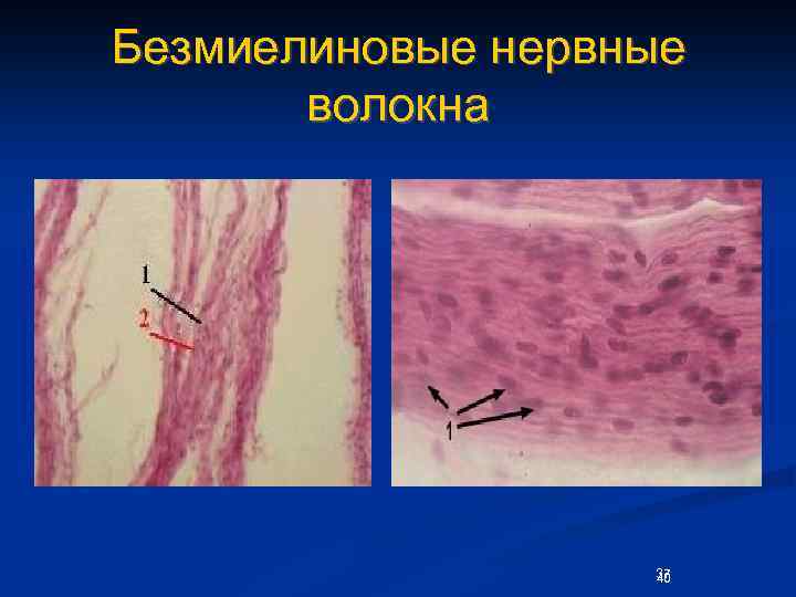 Безмиелиновые нервные волокна 37 40 
