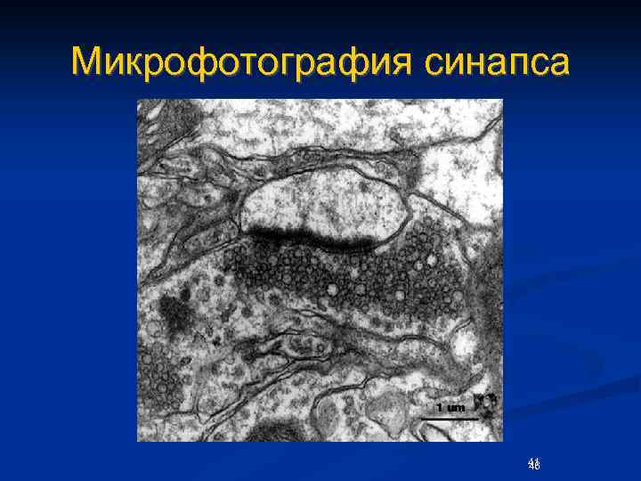 Микрофотография синапса 41 46 