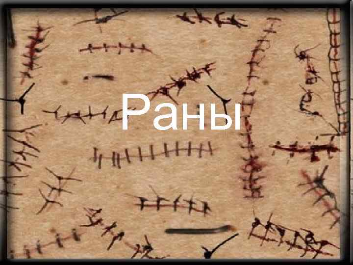 Раны 