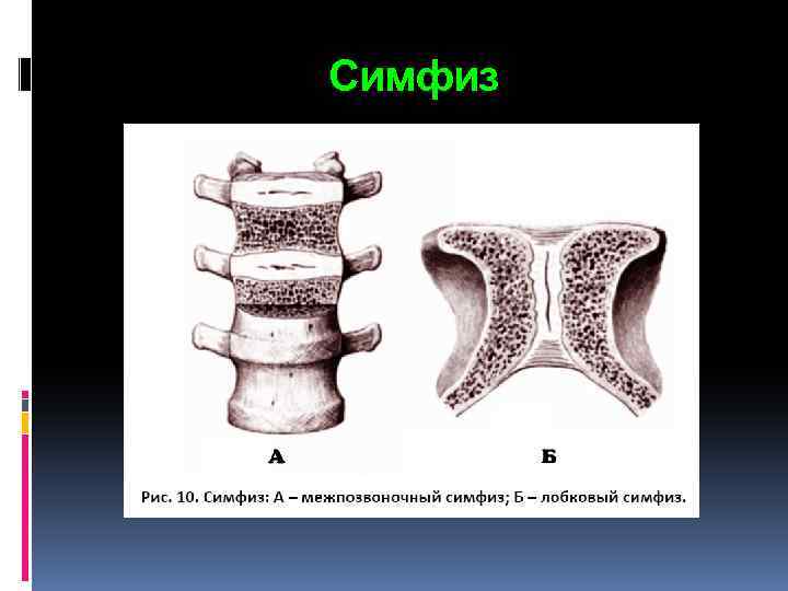 Симфиз 