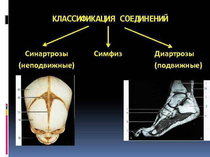 Симфиз это в анатомии. Синартрозы гемиартрозы диартрозы. Диартроз это подвижное соединение костей. Артрология классификация соединения костей. Классификация соединения костей (синартрозы, синхондрозы, диартрозы)..