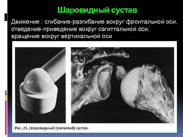 Шаровидный сустав Движение : сгибание-разгибание вокруг фронтальной оси, отведение-приведение вокруг сагиттальной оси, вращение вокруг