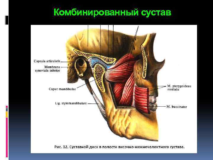 Комбинированный сустав 