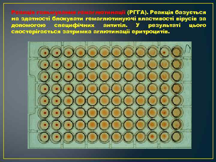 Реакція гальмування гемаглютинації (РГГА). Реакція базується на здатності блокувати гемаглютинуючі властивості вірусів за допомогою