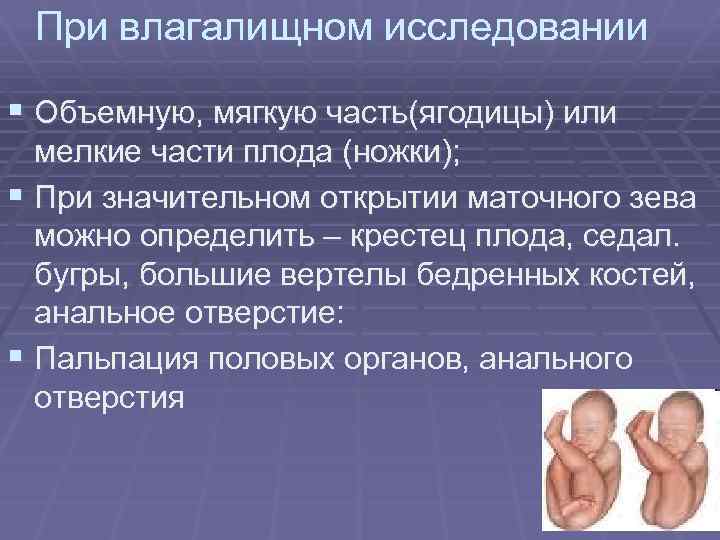 При влагалищном исследовании § Объемную, мягкую часть(ягодицы) или мелкие части плода (ножки); § При