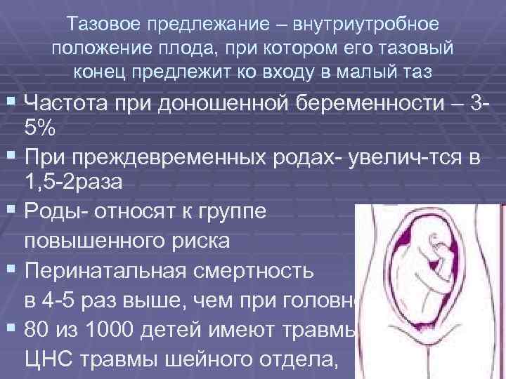 Тазовое предлежание – внутриутробное положение плода, при котором его тазовый конец предлежит ко входу