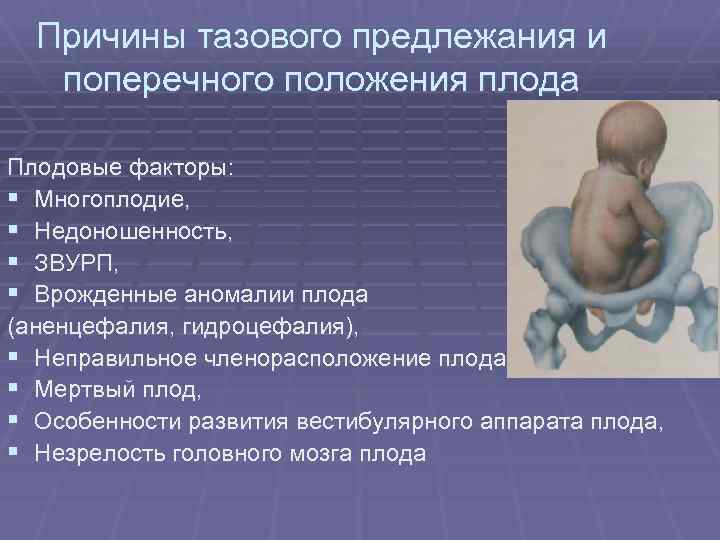 Причины тазового предлежания и поперечного положения плода Плодовые факторы: § Многоплодие, § Недоношенность, §