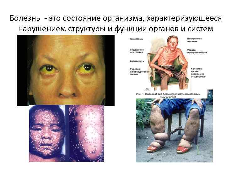 Болезнь - это состояние организма, характеризующееся нарушением структуры и функции органов и систем 