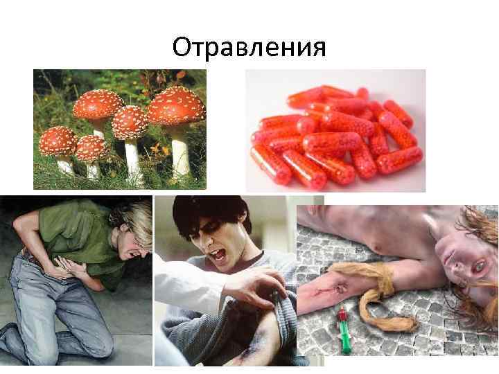 Отравления 