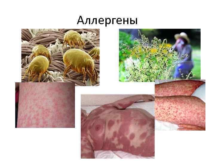 Аллергены 
