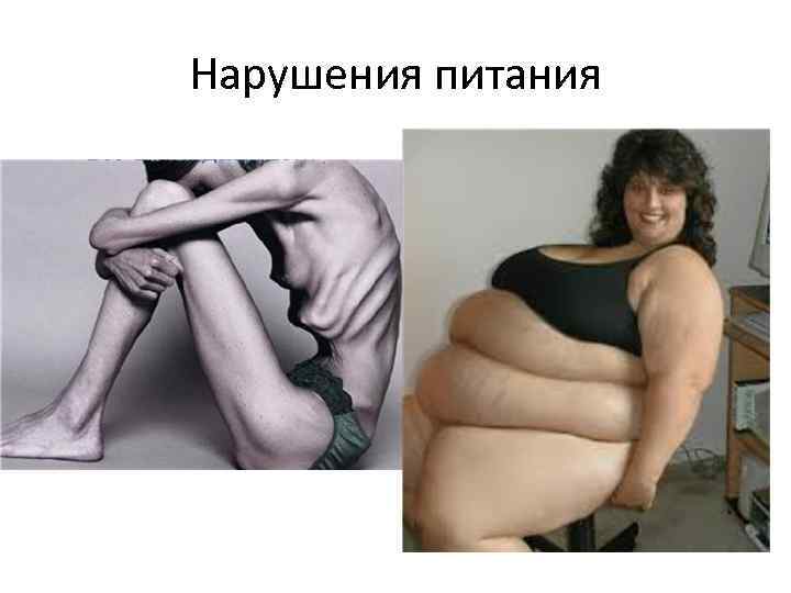 Нарушения питания 