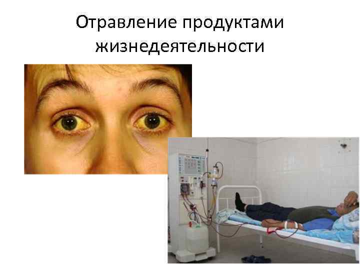 Отравление продуктами жизнедеятельности 