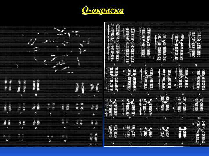 Q-окраска 