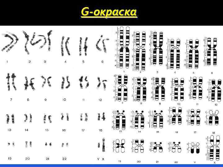 G-окраска 