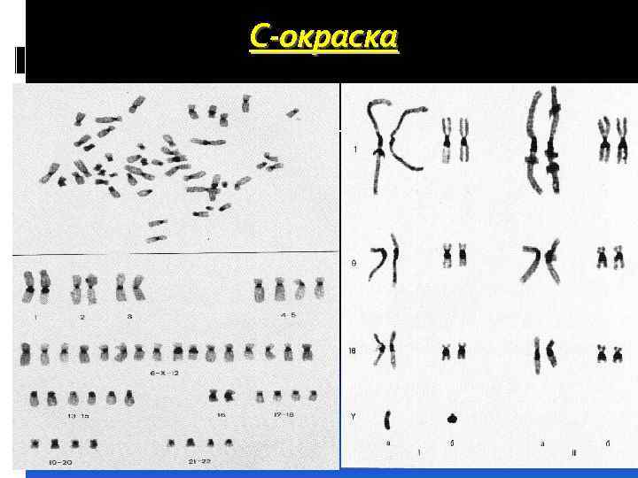 С-окраска 