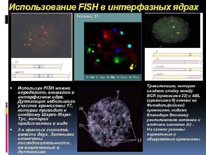 Использование FISH в интерфазных ядрах Используя FISH можно определить аномалии в интерфазном ядре. Дупликация