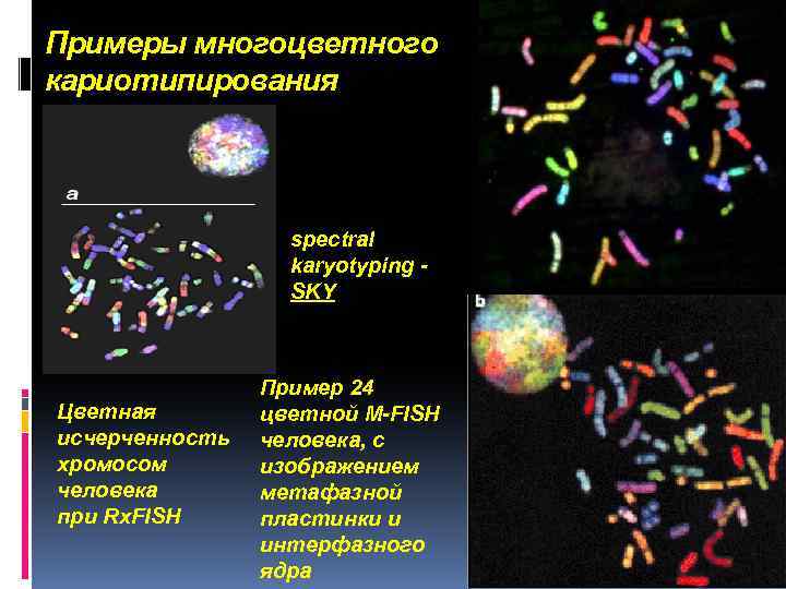 . Примеры многоцветного кариотипирования spectral karyotyping SKY Цветная исчерченность хромосом человека при Rx. FISH