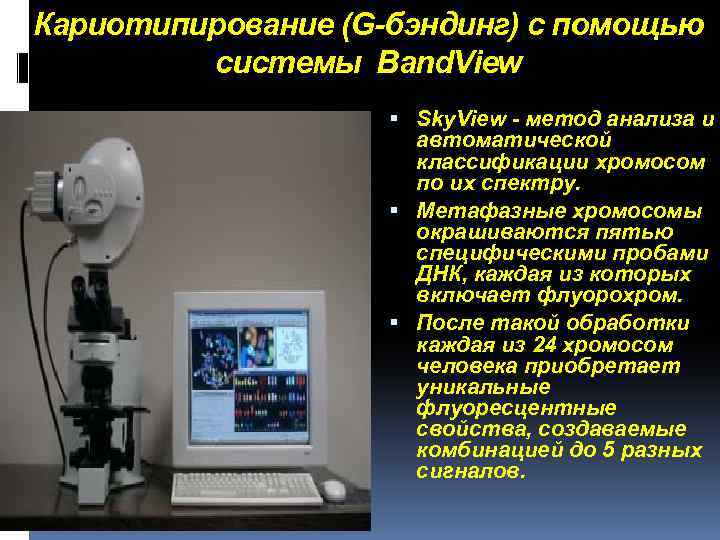 Кариотипирование (G-бэндинг) с помощью системы Band. View Sky. View - метод анализа и автоматической