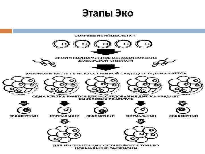 Этапы Эко 