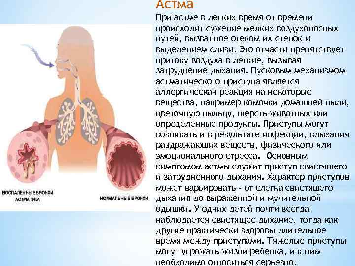 Астма При астме в легких время от времени происходит сужение мелких воздухоносных путей, вызванное