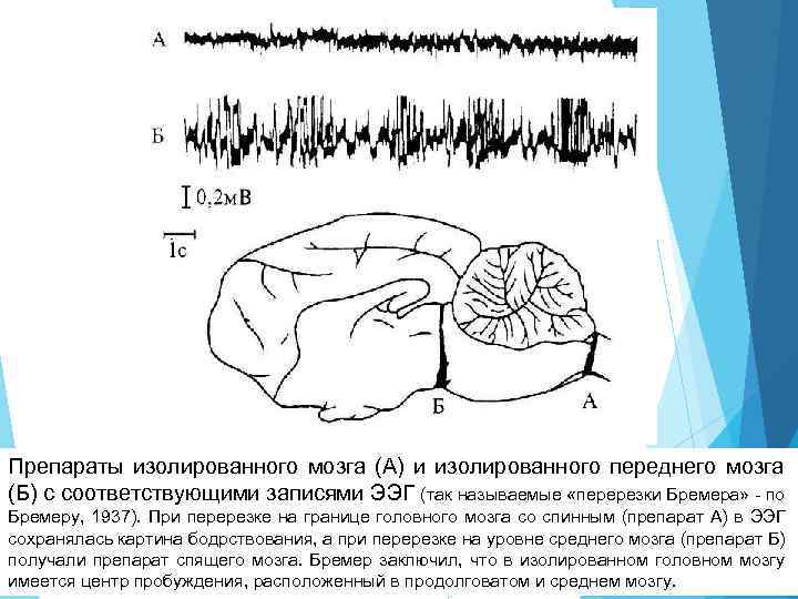 А б мозговой