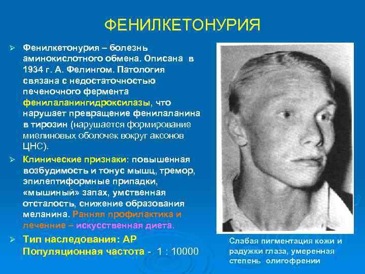 ФЕНИЛКЕТОНУРИЯ Фенилкетонурия – болезнь аминокислотного обмена. Описана в 1934 г. А. Фелингом. Патология связана