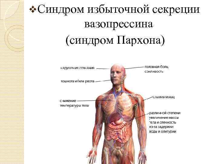 Синдром пархона презентация