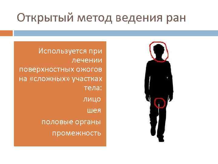 Открытый метод ведения ран Используется при лечении поверхностных ожогов на «сложных» участках тела: •